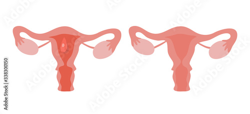 Periods. Menstruation. Modern vector cartoon uterus illusration.
