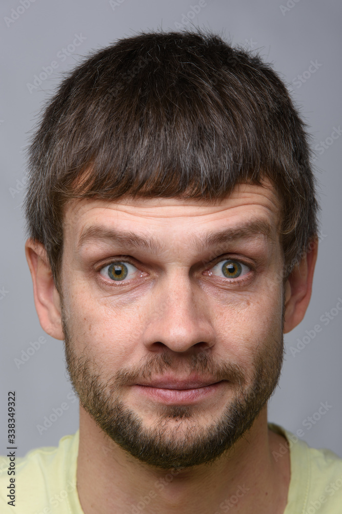 Close-up portrait of a man with bulging eyes of European appearance Close-up portrait of a man with bulging eyes of European appearance