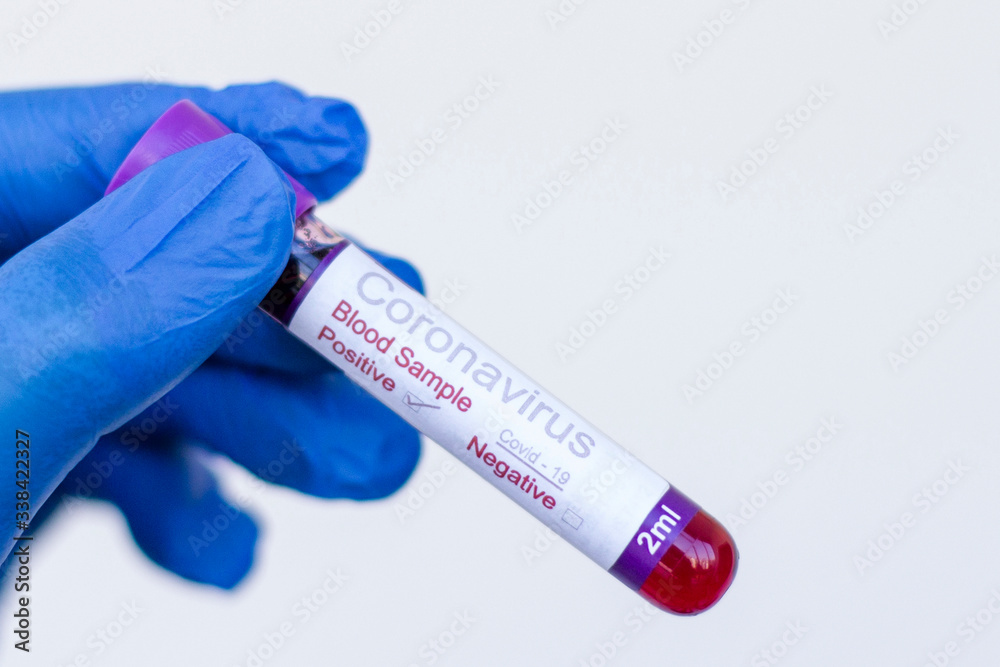 Fototapeta premium A gloved junior doctor holding a positive blood test result for coronavirus in Turkey
