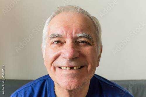 Obraz na plátně old man senior face closeup missing tooth smile proper dental care insurance hea