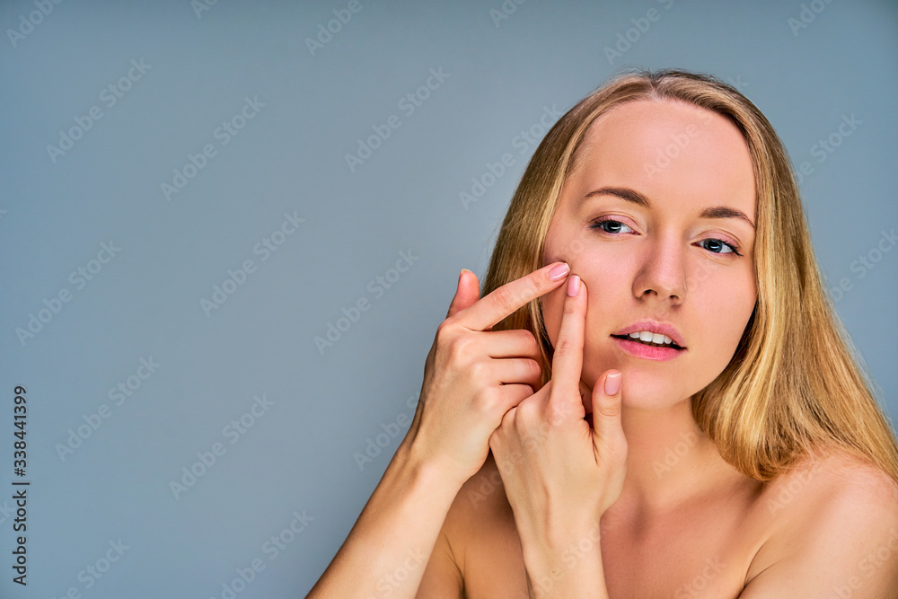 Close up woman squeezes acne on her cheek with her fingers. Beauty concept