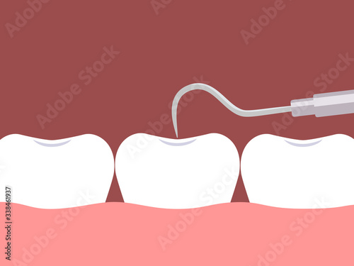 Checkup of a tooth by a dental explorer. Vector illustration
