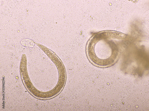 Strongyloides stercoralis or threadworm in human stool, analyze by microscope, original magnification 400x photo