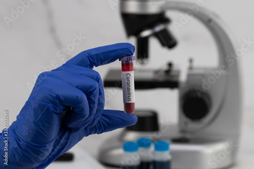 Nurse holding test tube with blood, close-up. Blood test concept