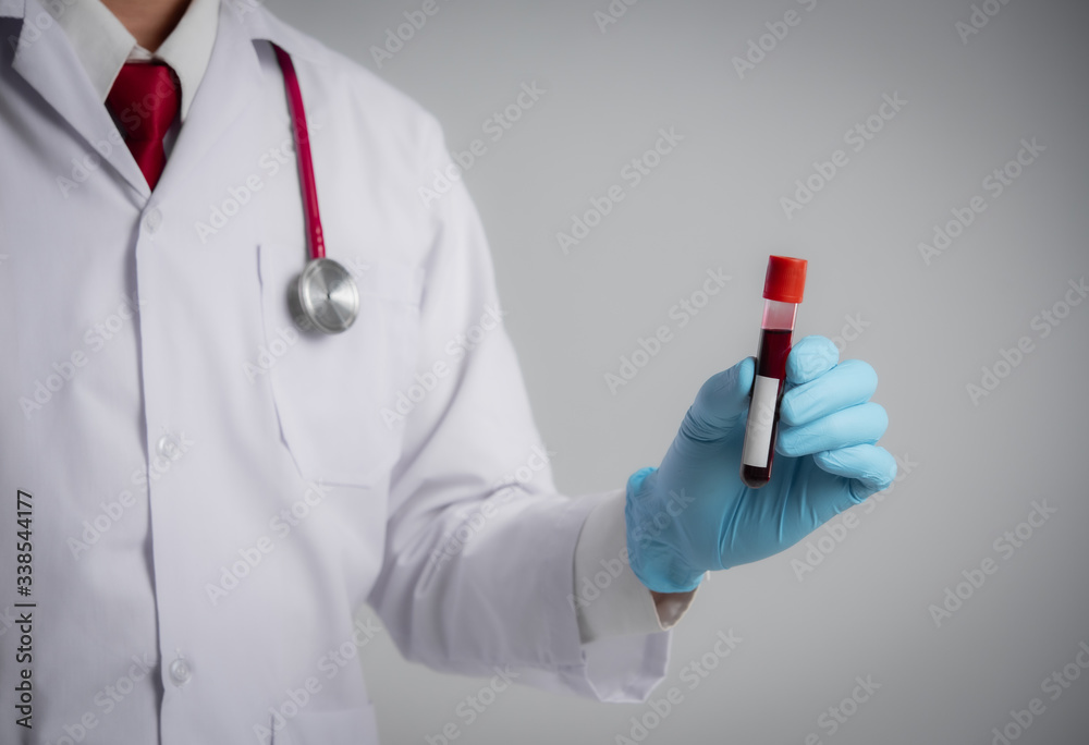 Hand of a doctor holding test tube with blood plasma ready for testing Hand of a doctor holding test tube with blood plasma ready for testing