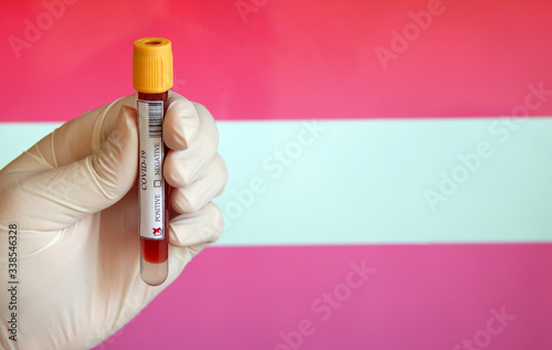COVID-19 Pandemic Coronavirus concept ; Close-up of a Positive COVID-19 blood test sample tube with Flag of Austria at background. Blood testing for diagnosis new Corona virus infection.
