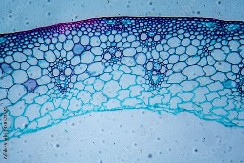 Microscopic image of wheat stem cross-section
