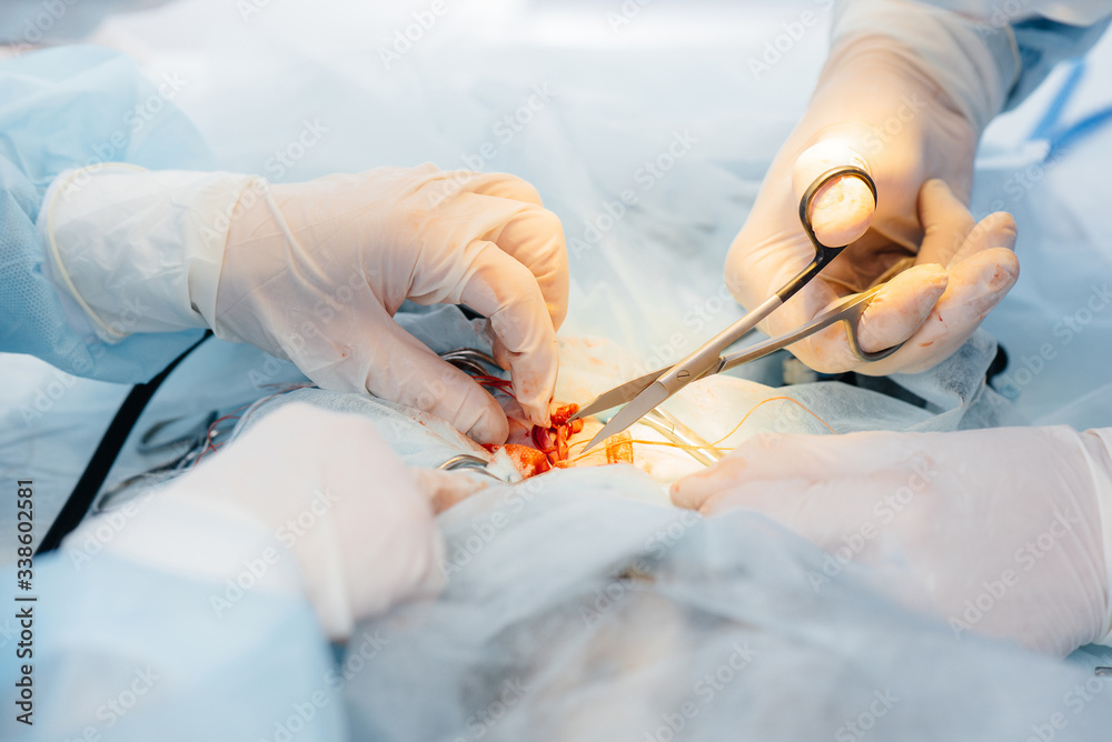 Operation in a modern operating room close-up, emergency rescue and resuscitation of the patient. Medicine and surgery Operation in a modern operating room close-up, emergency rescue and resuscitation of the patient. Medicine and surgery