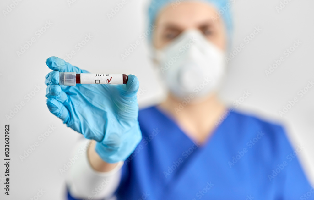 medicine, health and pandemic concept - close up of young female doctor or nurse holding beaker with coronavirus blood test medicine, health and pandemic concept - close up of young female doctor or nurse holding beaker with coronavirus blood test