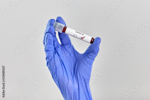 medicine, healthcare and virus concept - close up of hand in protective medical glove holding beaker with coronavirus blood test