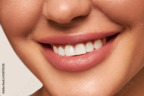Closeup Of Beautiful Smile With White Teeth. Woman Mouth Smiling. High Resolution Image