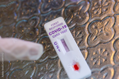 COVID-19 rapid test kit is a qualitative lateral flow immunochromatographic assay for the detection of IgM and IgG antibodies to SARS-CoV-2 in human whole blood, serum or plasma samples.