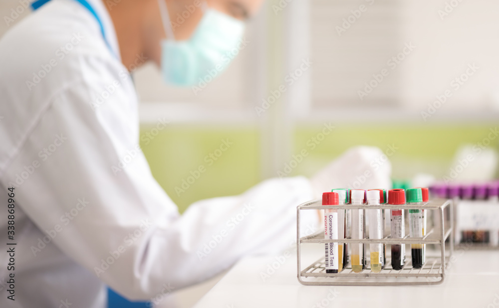 Blood test tube for laboratory analysis.Laboratory testing patient’s blood samples.Conceptual image coronavirus (COVID-19) test tube sample that has tested positive for coronavirus. Blood test tube for laboratory analysis.Laboratory testing patient’s blood samples.Conceptual image coronavirus (COVID-19) test tube sample that has tested positive for coronavirus.