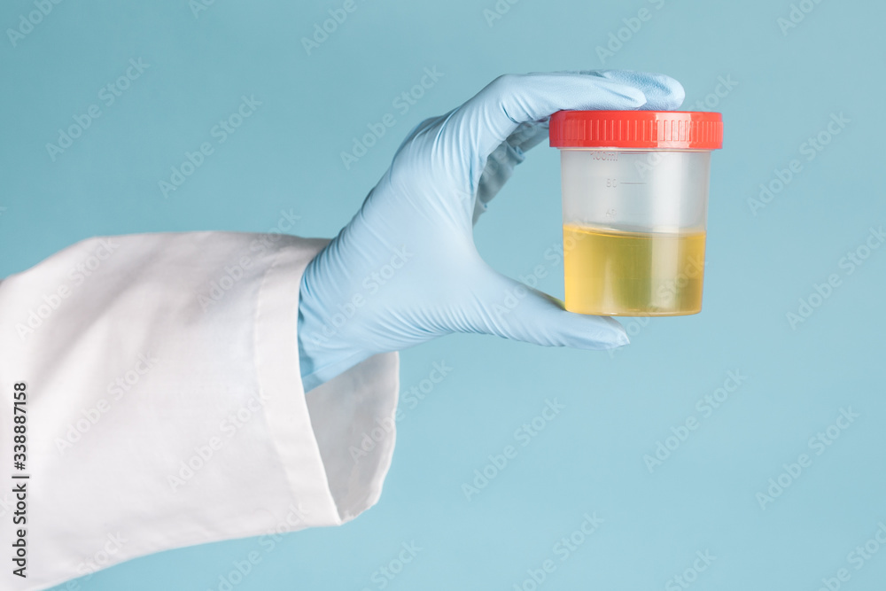 test tube with a urine test in the doctor's gloved hand test tube with a urine test in the doctor's gloved hand