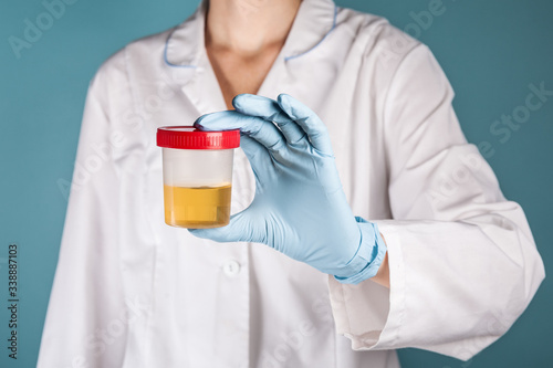 container for urinalysis in the hand of the doctor