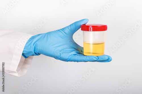 test tube with a urine test in the doctor's gloved hand