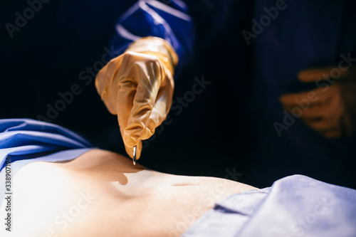Close-up of surgeon making an incicion during an operation