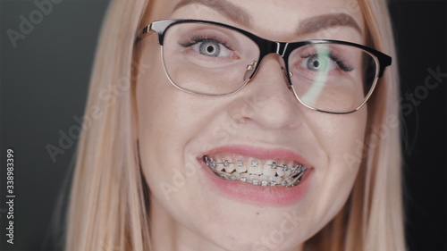 Attractive blonde hair business woman in glasses is looking at camera and smiles to show teeth braces standing at black background. Orthodontic treatment concept. Slowmotion closeup portrait 4K video