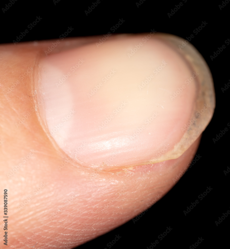 A finger on a man’s hand is isolated on a black background. A finger on a man’s hand is isolated on a black background.