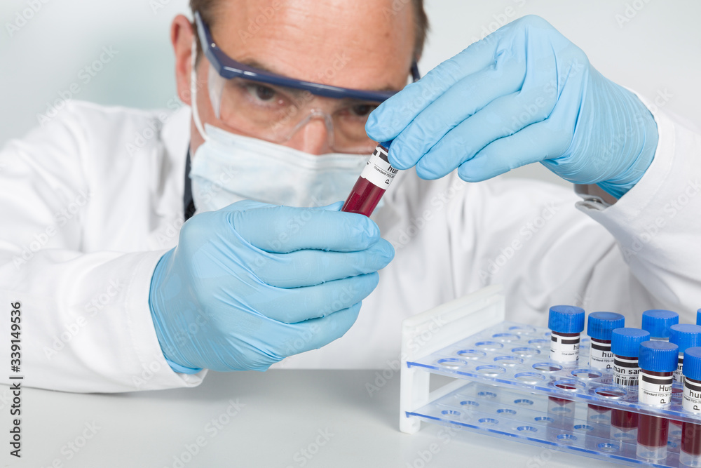 scientist works with medical gloves and medical face mask with blood samples for virus testing in a tube rack