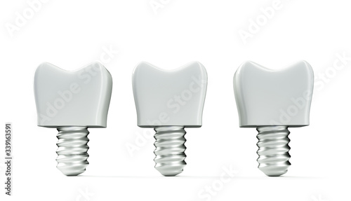 3d Render White Tooth Implant Denture Icon Set Closeup Isolated on White Background. Dental, Medicine and Health Concept. Design Template of Prosthesis Structure. Front View