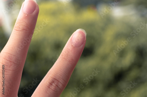 Picture of Fingers or Hand © HansenThedy