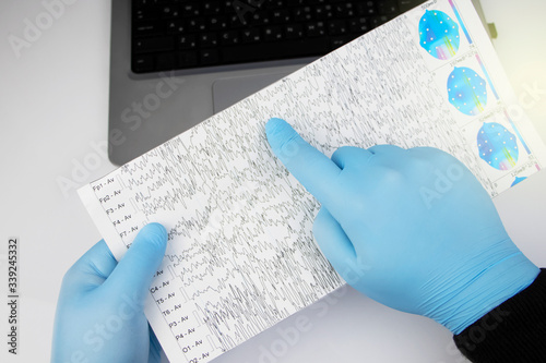 A neurologist examines an encephalogram of a patient’s brain. Schedule of electroencephalograms - study of brain currents for signs of epilepsy and pathologies of the nervous system photo