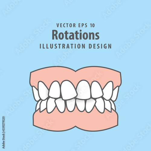 Dental rotations teeth illustration vector design on blue background. Dental care concept.