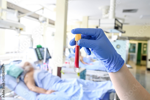 Blood sample test tube in hands of intensive care unit nurse. Corona virus outbrake image.