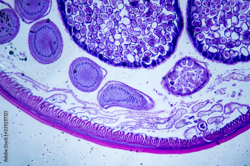 Microscopic image of Ascarid (cross-section)