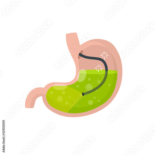 Gastroscopy. Endoscopy and digestive problems. Hose with camera. Procedure with internal organs. Cartoon flat illustration. Medical Visual inspection of stomach