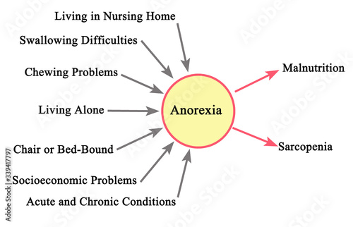  Anorexia: its causes and consequences