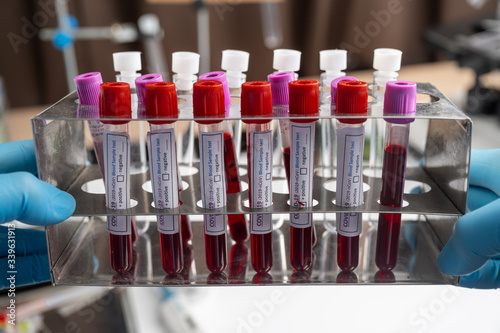 Medical equipment. Blood sample test in medical laboratory