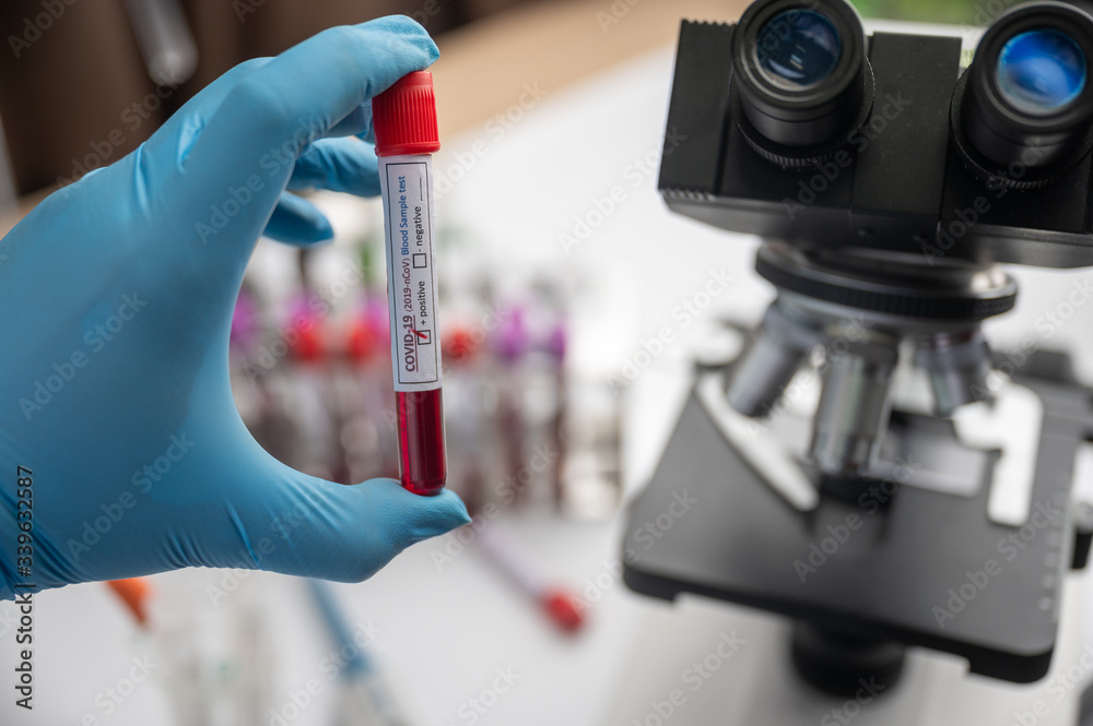 Medical equipment. Blood sample test in medical laboratory