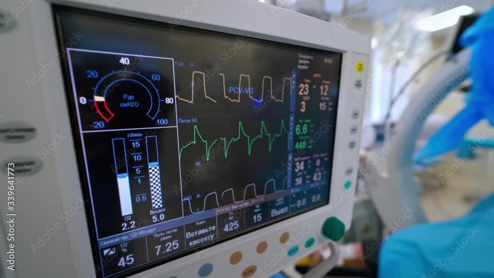 Intensive care emergency room with artificial lung ventilation monitor. Ventilation of the lungs with oxygen. COVID-19 and coronavirus identification. Intensive care emergency room with artificial lung ventilation monitor. Ventilation of the lungs with oxygen. COVID-19 and coronavirus identification.