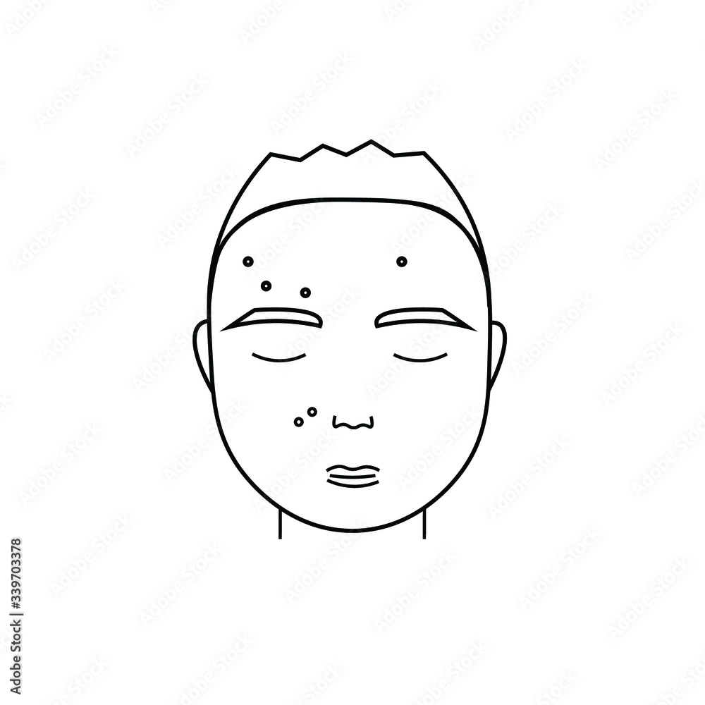 fat guy with acne. black vector graphics fat guy with acne. black vector graphics