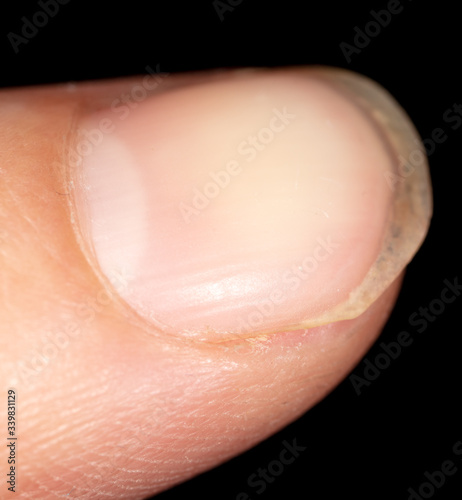 A finger on a man’s hand is isolated on a black background.