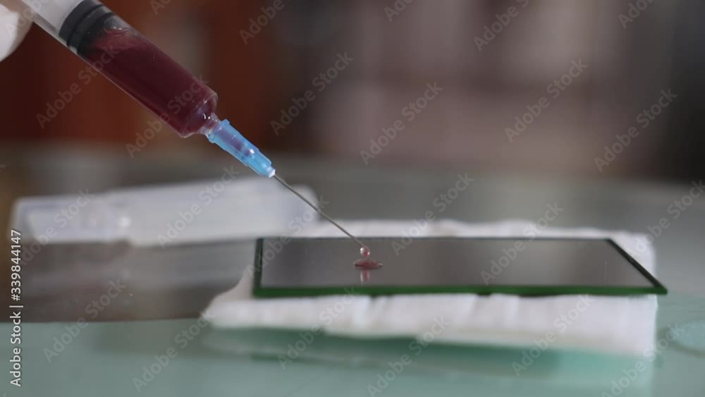 Laboratory for testing or creating virus vaccine. Syringe squeezes out drop of solution with blood on histological glass, close up. Preventing threat of epidemic, biological contamination, quarantine