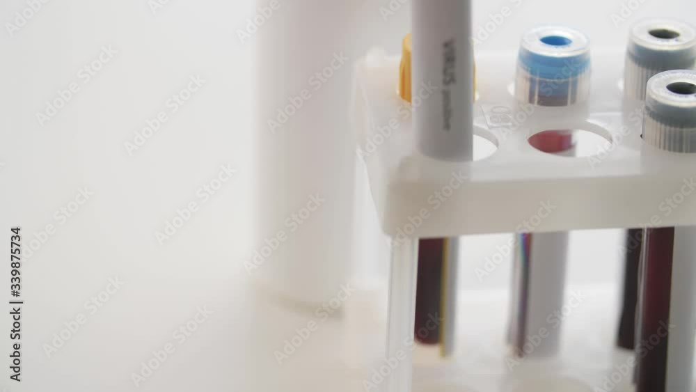 medicine, healthcare and pandemic concept - close up of hand in protective medical glove putting beaker with positive virus blood test into holder