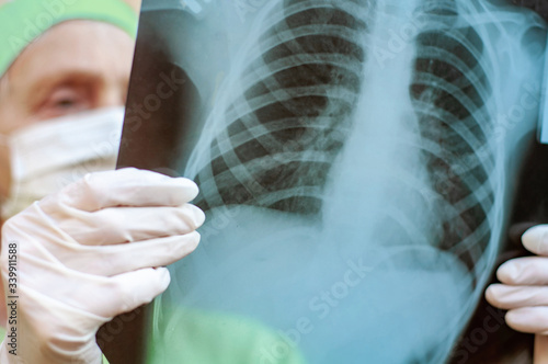 An elderly doctor pulmonologist in medical clothes examines an x-ray of the patient's lungs. Pandemic covid-19 coronavirus. Diagnosis and detection of viral pneumonia ncov. People's health