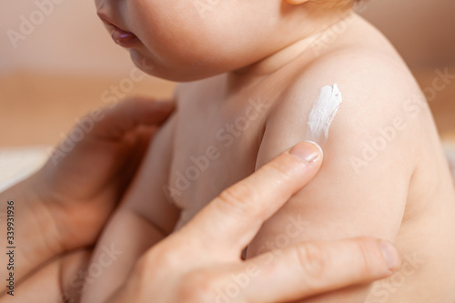Фотография Creaming baby skin cream. Male fingers smear cream on the child.