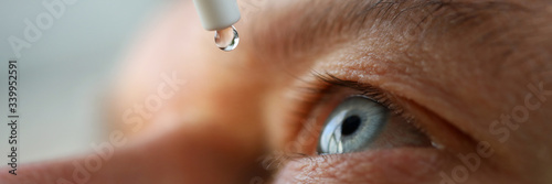 Man drops eye drops install lenses, moisturizing photo