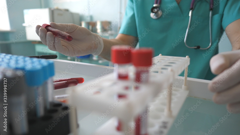 Scientist tests blood samples to COVID-19 and adds test tube in rack at lab. Doctor exams test tube with blood sample to coronavirus. Concept of health and safety life from pandemic of corona virus Scientist tests blood samples to COVID-19 and adds test tube in rack at lab. Doctor exams test tube with blood sample to coronavirus. Concept of health and safety life from pandemic of corona virus