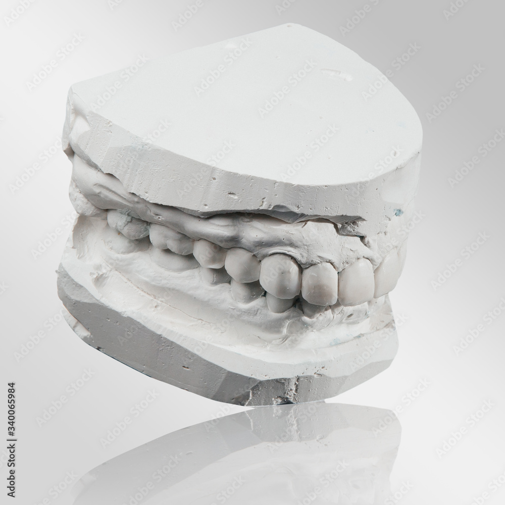 medicine, tooth, dentistry, impression, prosthesis, dentist, dental