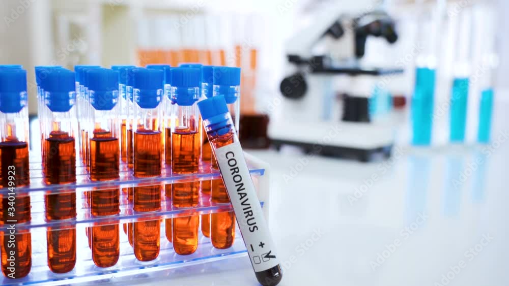 The coronavirus or Covid-19 blood sample kit on the table
