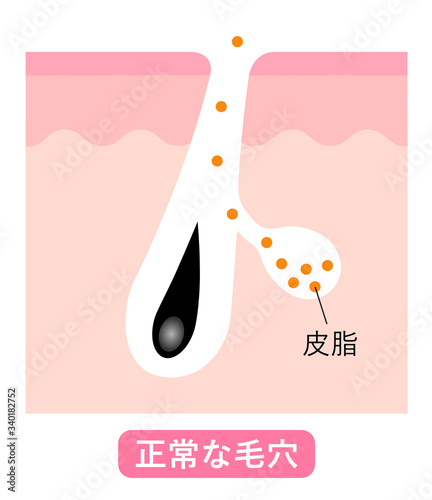 正常な毛穴　肌の断面図