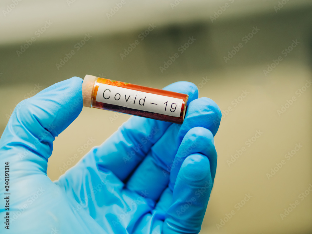 Obraz premium gloved hand showing a blood sample for analysis