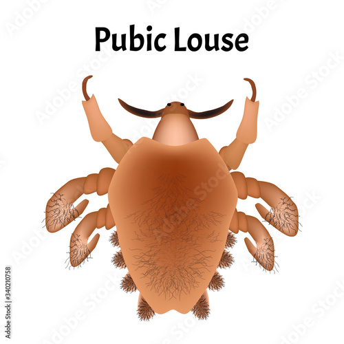 Parasitic diseases of Phthiriasis. Pediculosis pubis. Pubic lice structure. Sexually transmitted diseases. Infographics. Vector illustration on isolated background.
