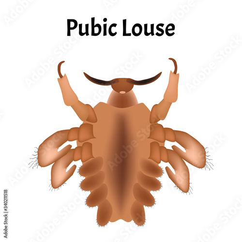 Parasitic diseases of Phthiriasis. Pediculosis pubis. Pubic lice structure. Sexually transmitted diseases. Infographics. Vector illustration on isolated background.