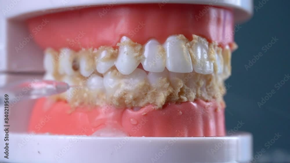 Teeth Cleaning Water Pressure Tooth jaw. Brushing teeth with a dental